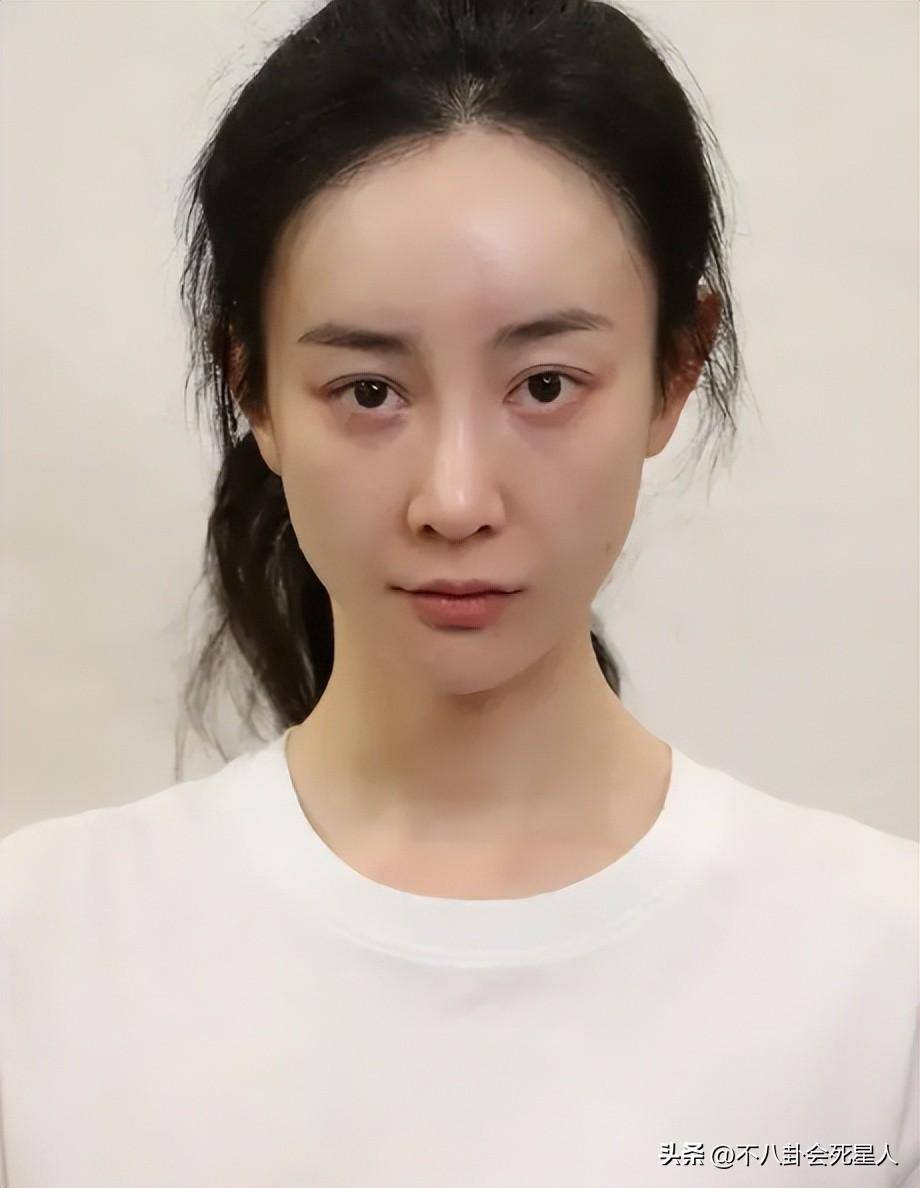 女明星整容吗_娱乐圈女星整容事件_徐冬冬戚薇景甜乔欣周笔畅张檬王鸥谢依霖