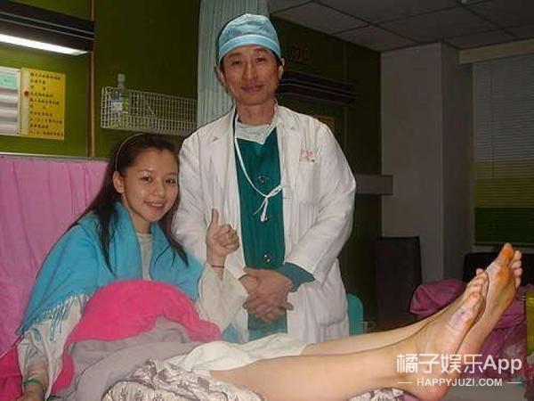 女明星的脚趾头最美_容祖儿拇指外翻_贝嫂拇指外翻手术