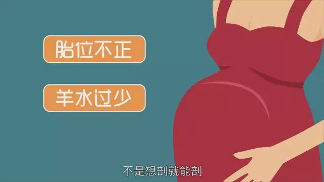 提前剖腹产_剖腹产风险_女明星 顺产