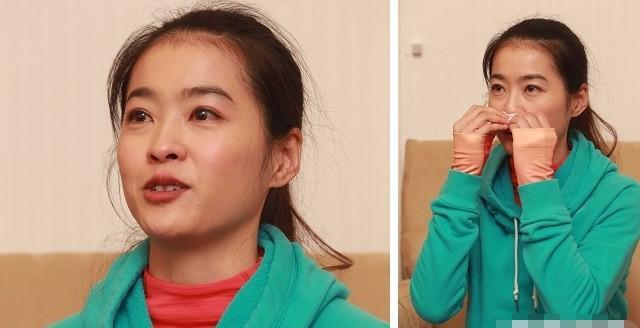 冯小刚白斑_明星病痛_女明星生理缺陷