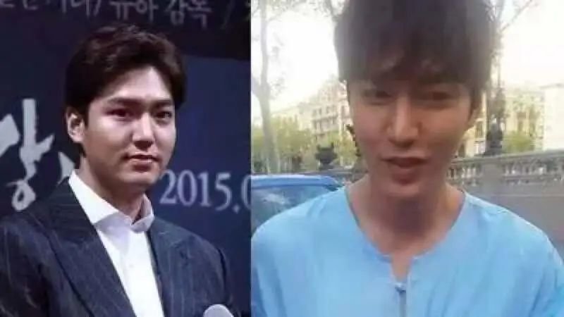 韩国女明星腿_韩国艺人变肿原因_韩国酵母现象分析