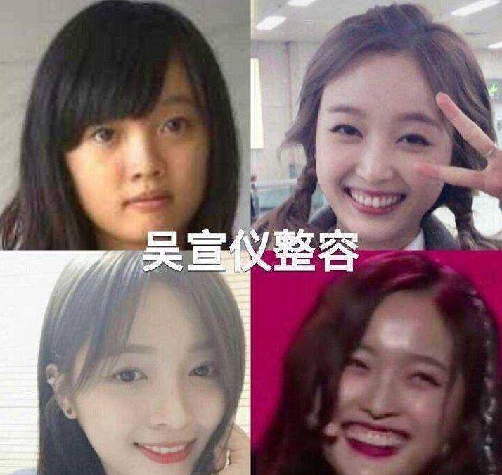 娱乐圈整容美女_美女整容前后对比_混血女明星鼻子