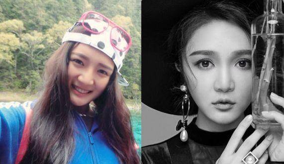 混血女明星鼻子_娱乐圈整容美女_美女整容前后对比