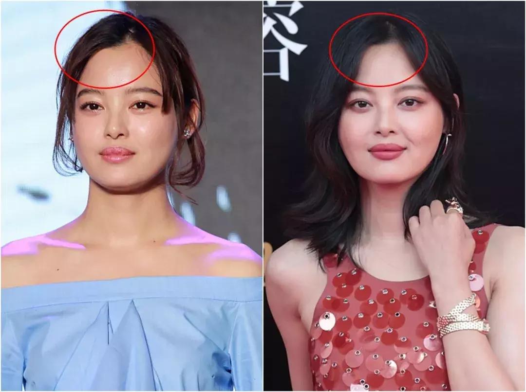 女明星短发造型_辛芷蕾短发分析_短发造型